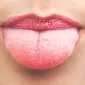 Jangan diabaikan, ini ciri-ciri kanker lidah yang sering disepelekan. (Sumber Foto: Healthline)
