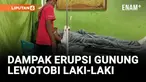 DUA KORBAN LUKA BAKAR SERIUS DAMPAK ERUPSI GUNUNG LEWOTOBI LAKI-LAKI