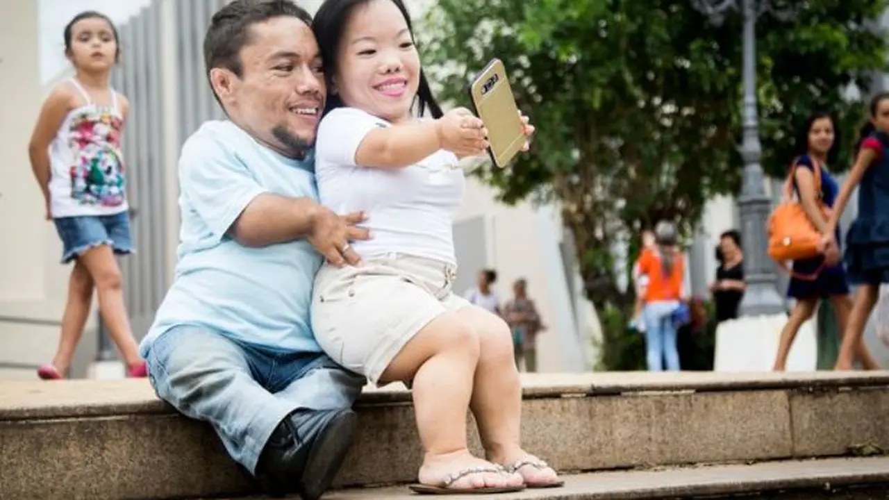 Heroik, Pasangan Terkecil di Dunia Berjuang Hadapi Pem-Bully-nya
