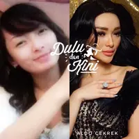 Dulu dan kini Zaskia Gotik. (Instagram/zaskiagotik)