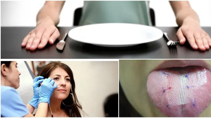 Foto: copyright chacha.com