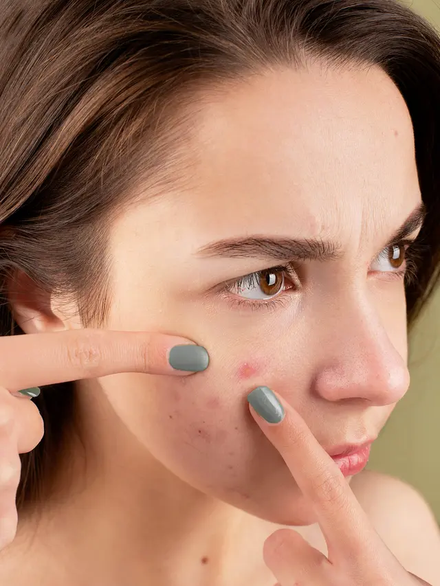 Muncul Jerawat Setelah Facial, Normal Nggak Sih? Gali Fakta dan Tips Perawatan yang Tepat