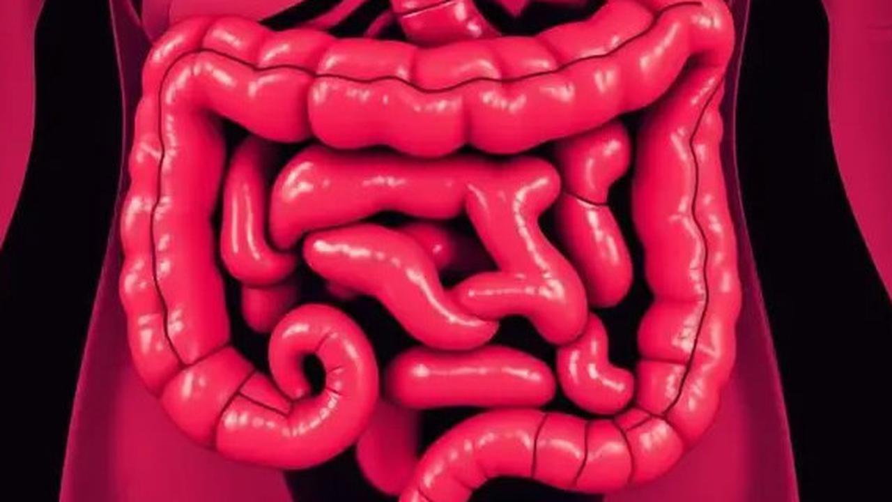 5 Cara Menurunkan Risiko Kanker Kolorektal atau Kanker Usus Besar