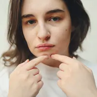 Ilustrasi cara menghilangkan jerawat dengan lidah buaya/Copyright pexels/Polina Tankilevitch