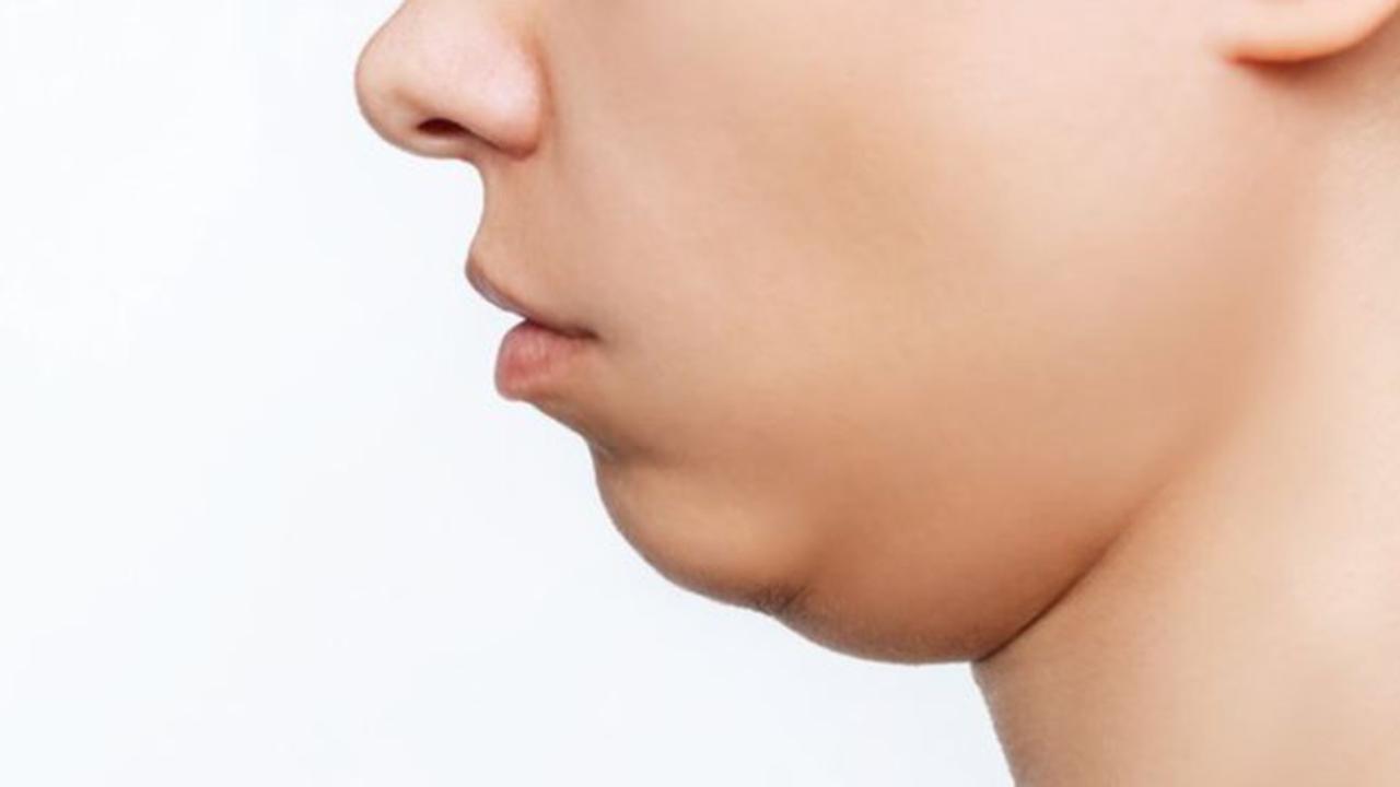 Bikin Wajah Lebih Tirus! Ini 6 Cara Alami Hilangkan Double Chin Tanpa Ribet