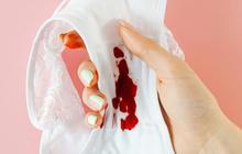 Siklus Menstruasi Berdampak pada Aktivitas Otak Wanita, Ini Penjelasan Ilmiahnya