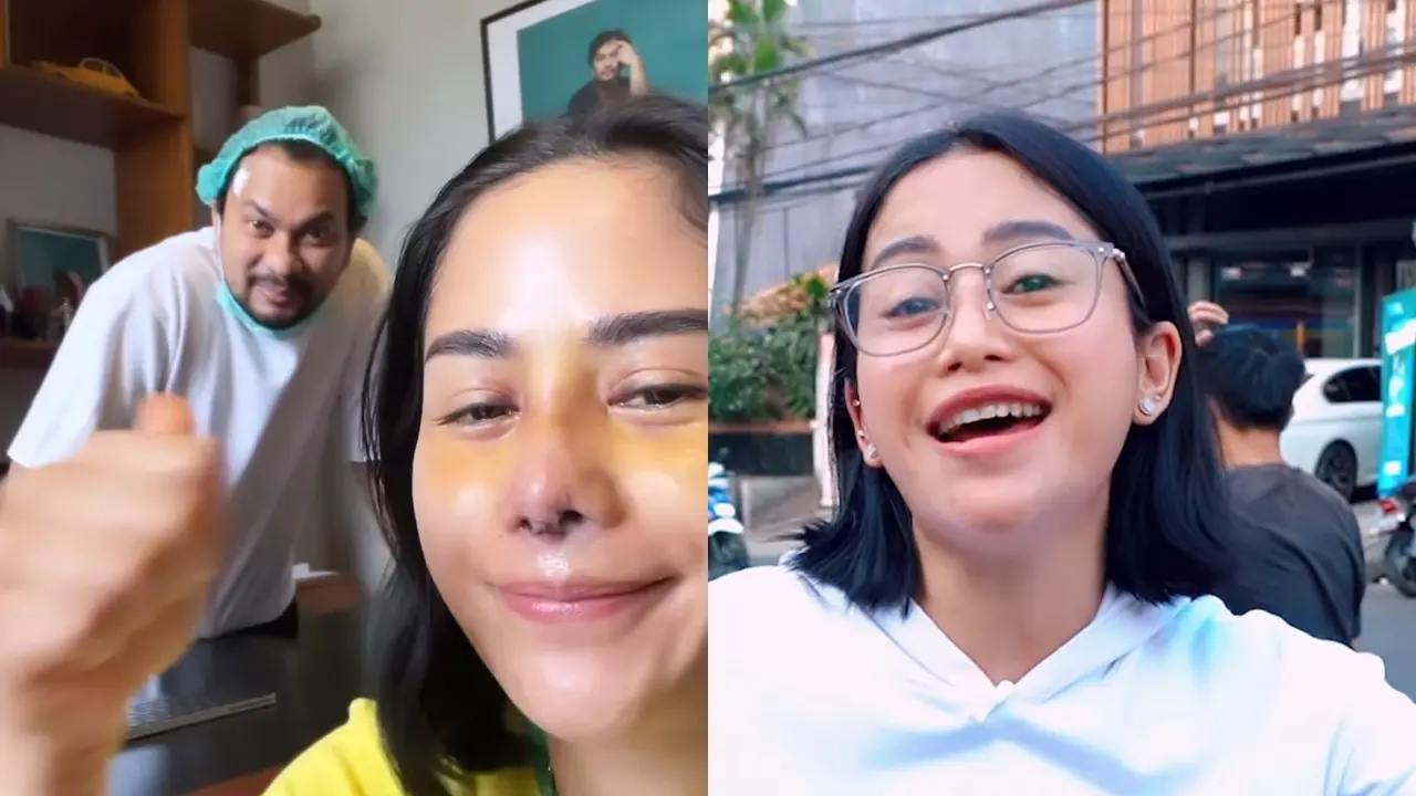 Potret Hasil Oplas Hidung Farida Nurhan