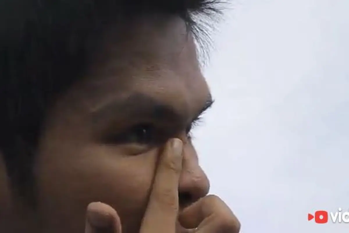 Masuk Lewat Hidung, Pria Ini Keluarkan Tisu Lewat Mata