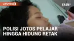 Kacau! Polisi di Bulukumba Aniaya Pelajar Perempuan hingga Alami Hidung Retak