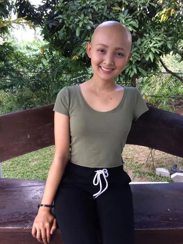 [Bintang] Satu Tangan Diamputasi karena Kanker, Gadis Cantik Ini Berbagi Kisah Hidupnya di Media Sosial