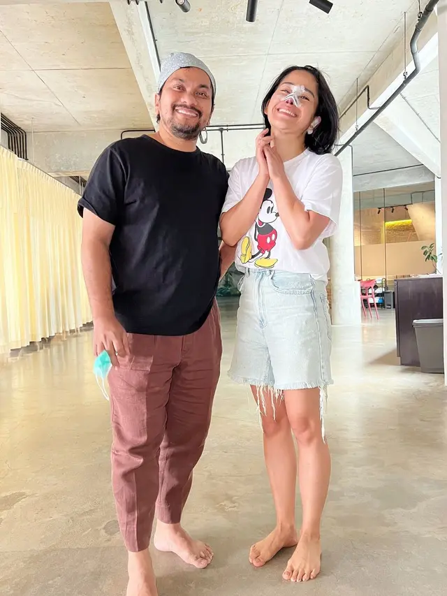 Potret Hasil Oplas Hidung Farida Nurhan