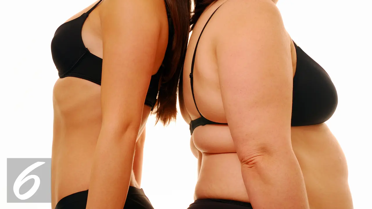 Ilustrasi Badan Gemuk atau Obesitas (iStockphoto)
