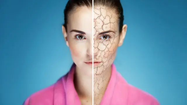 3 Efek Samping Pemakaian Retinol yang Kurang Tepat dan Cara Terbaik Mencegahnya