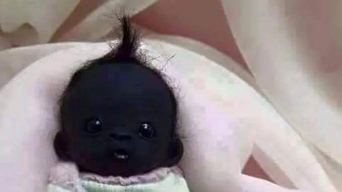 Hah? Ada Bayi 'Tergelap' Sedunia?