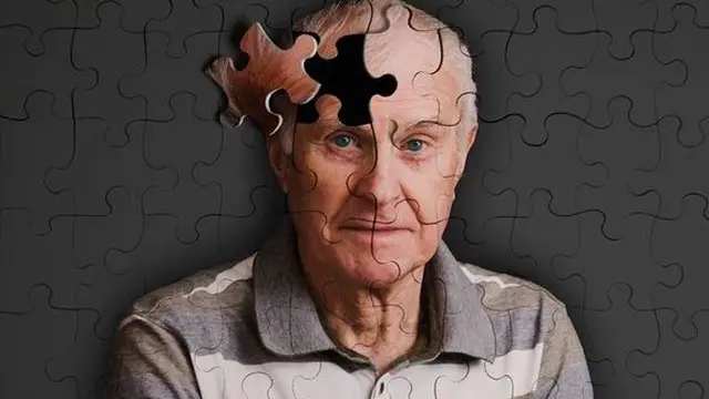 Alzheimer