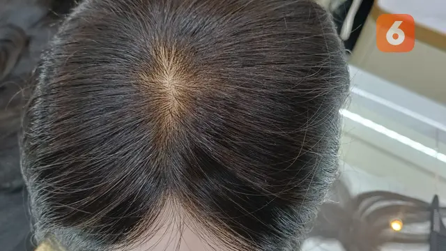 Mengenal Beda Wig, Toupe, dan Hair Clip, Penambah Kepercayaan Diri Instan