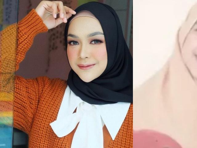 Dituding Operasi Plastik Ini 7 Potret Transformasi Ria Ricis Hot Liputan6 Com