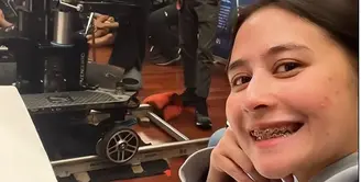 Prilly Latuconsina tunjukkan dirinya pakai behel. [Foto: Instagram/prillylatuconsina96]