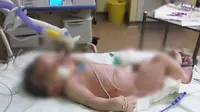 Terlambat Operasi Caesar, Bayi Tewas 8 Jam Setelah Lahir