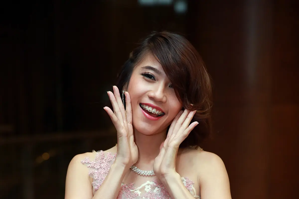 [Bintang] Gigi eks Cherrybelle