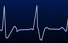 Apa Itu Resting Heart Rate? Kenali Standard yang Berbeda pada Setiap Orang