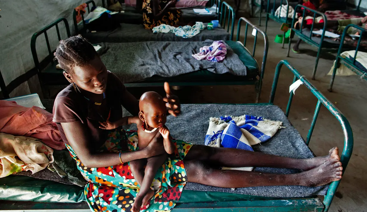 Seorang wanita saat mengasuh anaknya di sebuah klinik di Lankien, Sudan Selatan, (8/4).  Menurut MSF, Kekurangan gizi didaerah sudan selatan sudah mencapai batas kritis. (Albert Gonzalez Farran / cds / AFP)