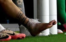 FOTO: Penampakan Bengkak Kaki Messi yang Keseleo hingga Membuat Menangis Tersedu-sedu di Final Copa America 2024