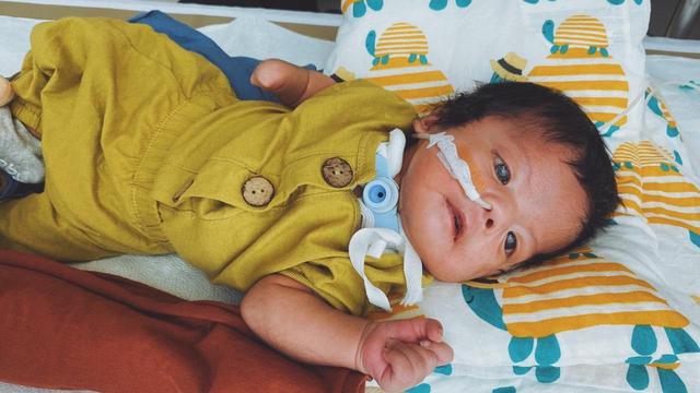 Terlahir Dengan Moebius Syndrome Dr Andreas Hiro Masih Berjuang Health Liputan6 Com