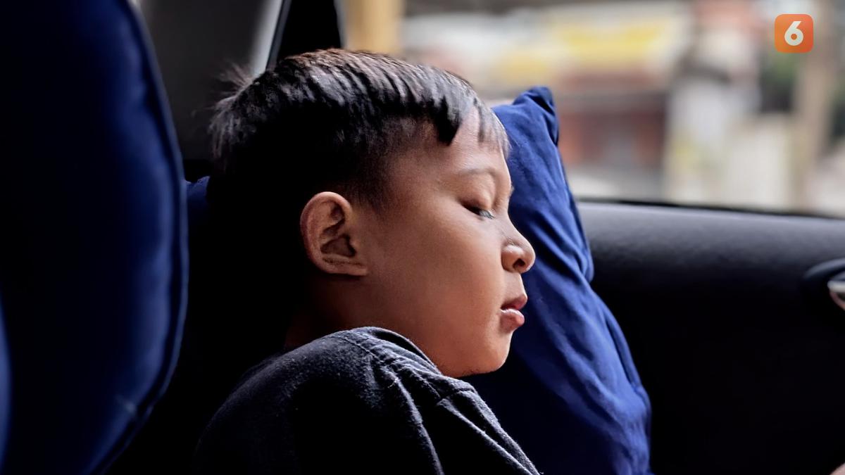 Sleep Apnea atau Gangguan Tidur Dapat Sebabkan Disabilitas, Kok Bisa?