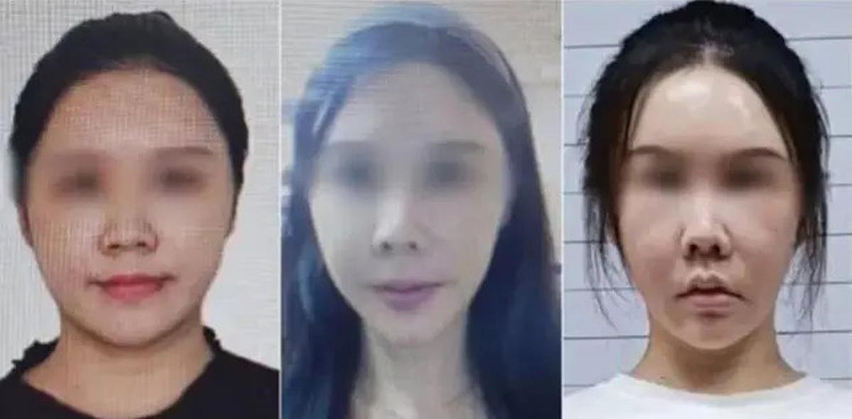 Wanita Ini Oplas Wajah Demi Mangkir dari Polisi, Perubahannya Bikin Pangling