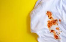 Tips Mudah Membersihkan Lap Dapur Kotor Tanpa Cairan Pemutih, Hanya Menggunakan Dua Bahan ini
