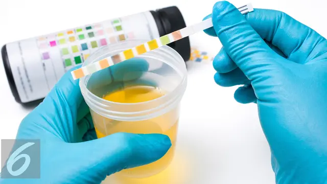 Ilustrasi Foto Air Seni atau Urine