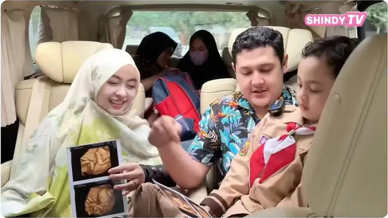 6 Potret Kakak Ria Ricis Periksa Kandungan Ditemani Suami, Bayi Aktif saat di USG