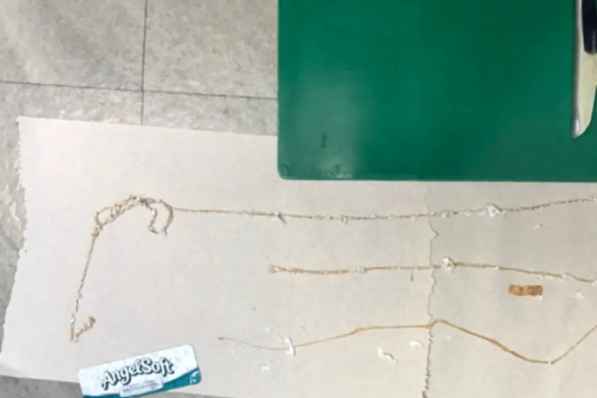 Suka Makan Sushi, Cacing Pita 1,7 Meter Keluar dari Anus Pria Ini