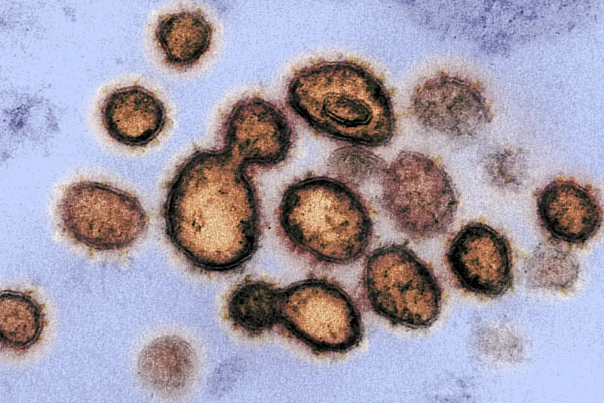 Ilustrasi gambar SARS-CoV-2, virus yang menyebabkan Corona COVID-19, diisolasi dari seorang pasien di AS. Diperoleh 27 Februari 2020 milik National Institutes of Health yang diambil dengan mikroskop elektron transmisi.(AFP/National Institutes Of Health)