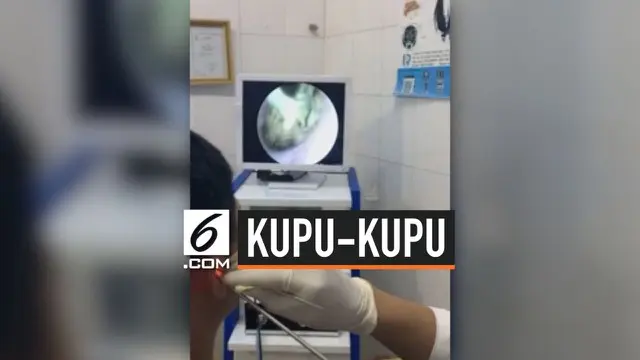 Dokter menemukan seekor kupu-kupu kecil di dalam telinga pasiennya di Vietnam. Hewan tersebut dalam keadaan mati saat dokter menariknya keluar.