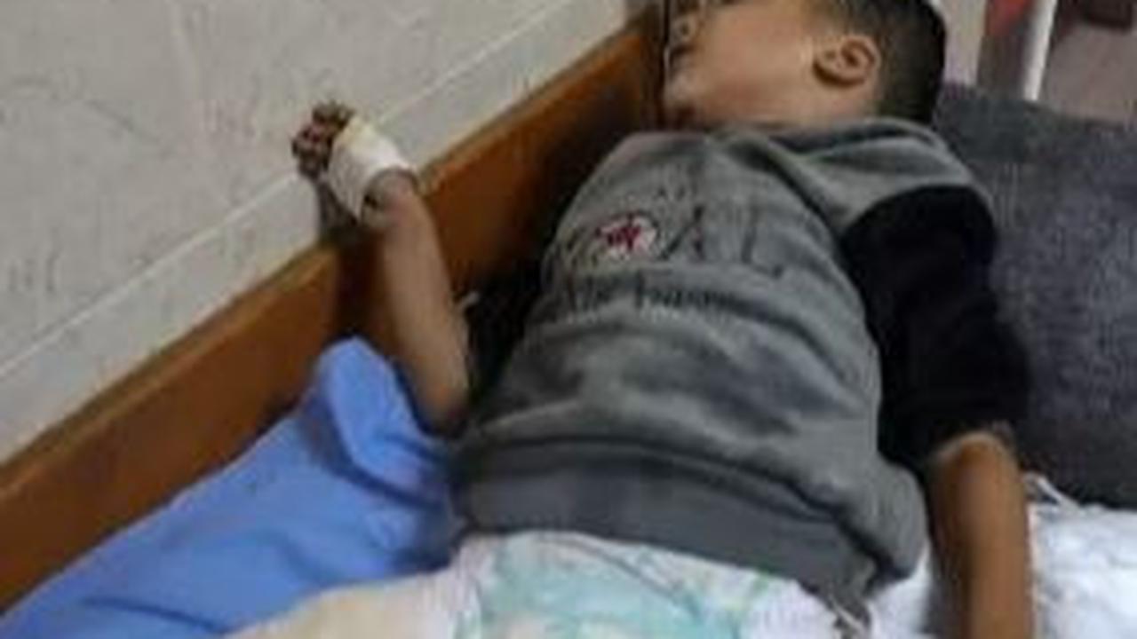 Kisah Pilu Bocah Tiga Tahun di Gaza, Bom Israel Renggut Semua Keluarganya dan Kini Harus Hidup Tanpa Kaki