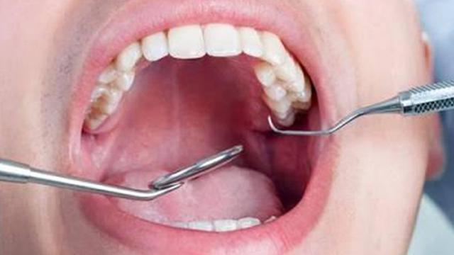 penyebab nyeri pada gigi di malaysia