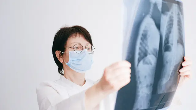 Penanganan Pasien Kanker Paru Semakin Parah Karena Diperburuk Pandemi, Ini Harapan Dokter dan Penyintas Kanker bagi Pemerintah