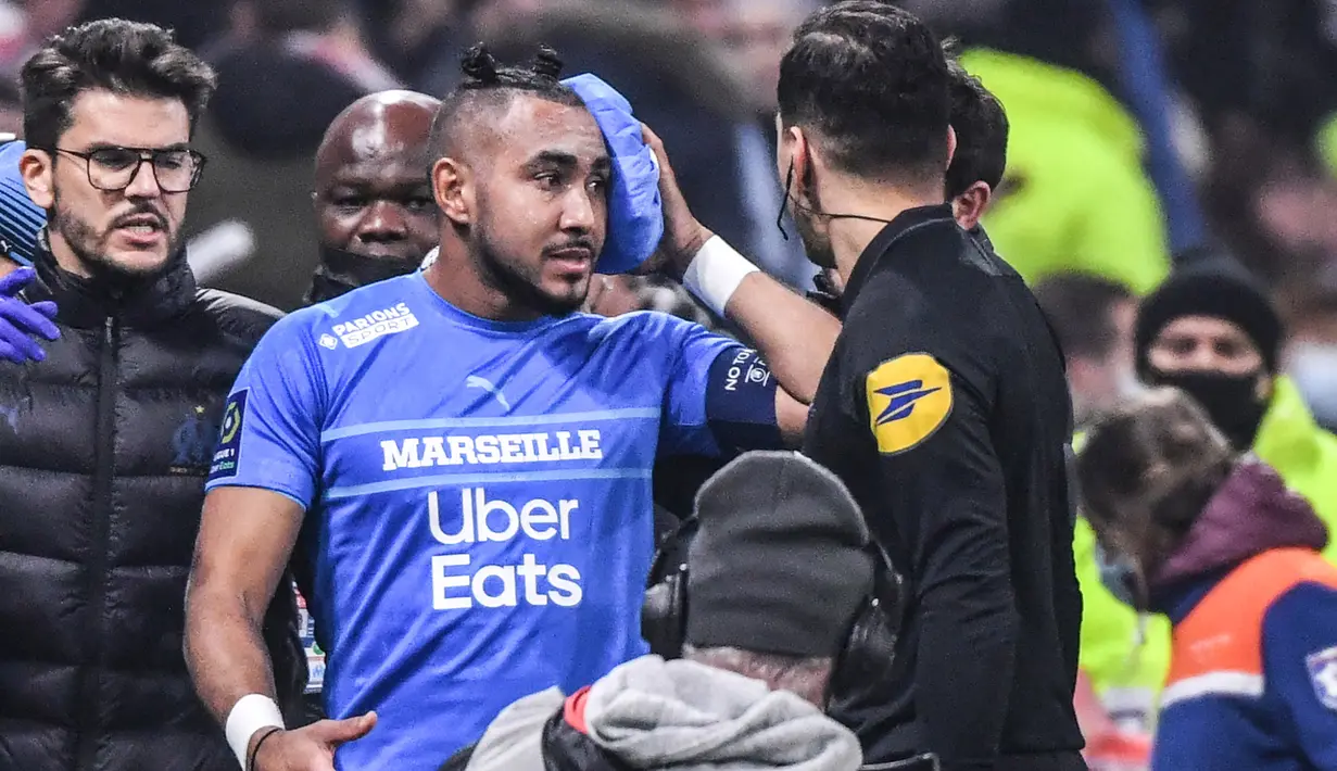 Namun tak berapa lama, Dimitri Payet dapat bangkit kembali dan mengkompres bagian kepalanya. (AFP/Philippe Desmazes)