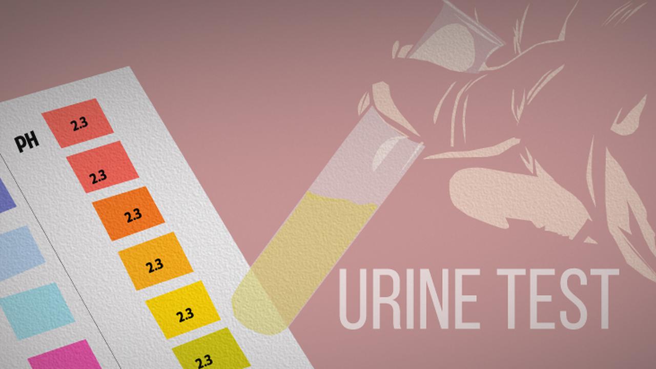 Ilustrasi Tes Urine 