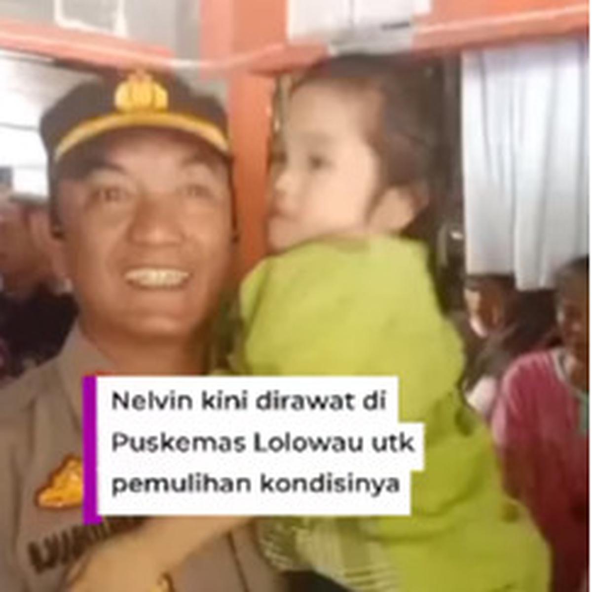 Potret Pilu Bocah Yatim Alami Cacat Fisik hingga Kaki Bengkok