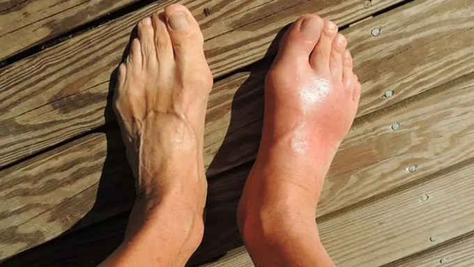 Copyright: pixabay.com