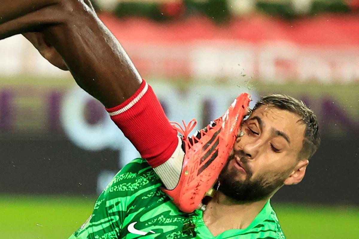 Wajah Donnarumma Berdarah-darah Usai Tendangan Horor Wilfried Singo