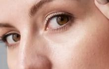 Mengatasi Kulit Kering, Pilih 10 Kandungan Skincare Terbaik