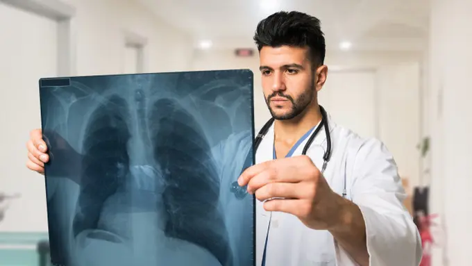 Penyebab Penyakit Pneumonia