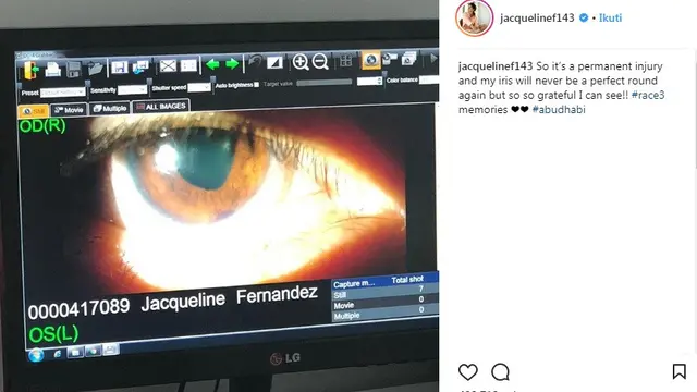 Mata Jacqueline Fernandez