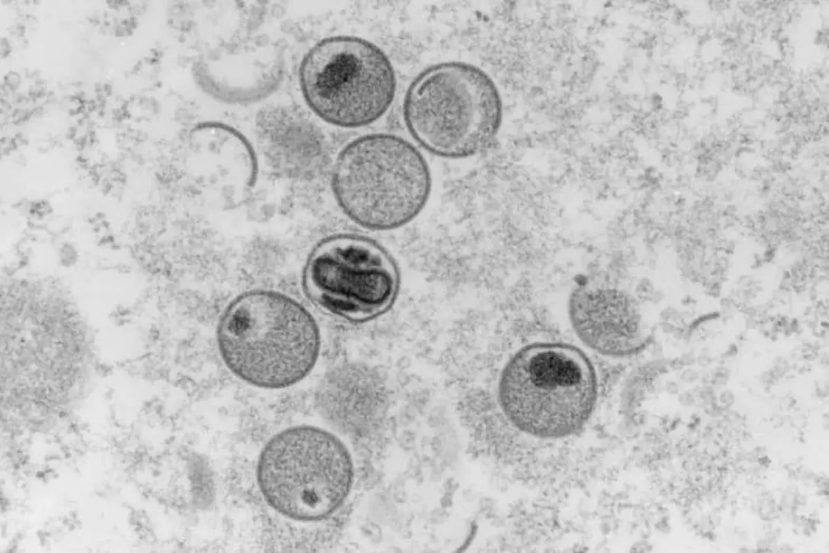 Tangkapan mikroskop elektron bagian ultratipis dari virus cacar monyet file 2004. (Gambar: AFP/RKI Institut Robert Koch/Freya Kaulbars)