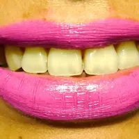 Kamu tak berani tersenyum lebar karena gigi berwarna kuning? Mungkin ini penyebabnya! | via: pxdkitty.blogspot.com