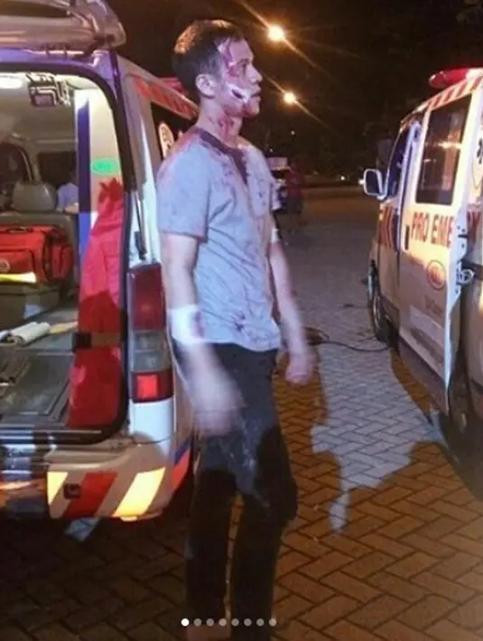 Junot mengaku selama proses pembuatan film, badannya hingga memar dan luka-luka. "Luka-luka, sama biru-biru, keseleo-keseleo dan sebagainya udah. Kayaknya semua pemain pernah sih," lanjut Junot. (Instagram/herjunotali)